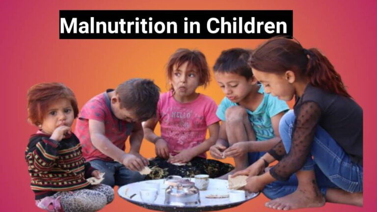 MALNUTRITION IN CHILDREEN
