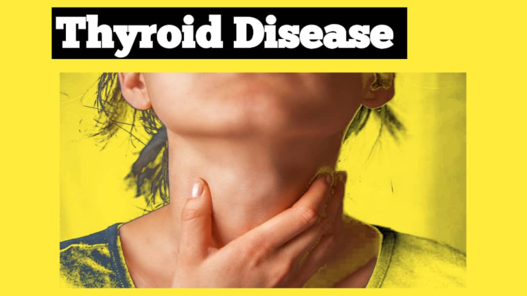 THYROID DISEASE