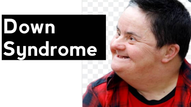 DOWN SYNDROM